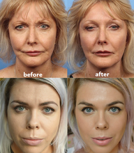 Lade das Bild in den Galerie-Viewer, ANTI-FALTEN-PADS | 50% RABATT HEUTE