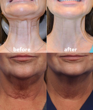 Lade das Bild in den Galerie-Viewer, ANTI-FALTEN-PADS | 50% RABATT HEUTE