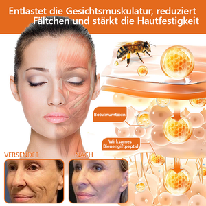 1+1 Gratis | Beuven™ - All-in-One-Reparaturcreme