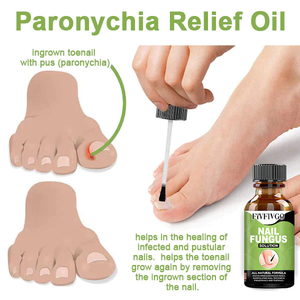 Nagelpilz Lösung- Gel zur Entfernung von Paronychie