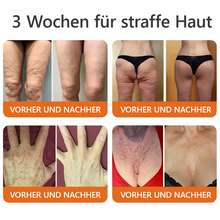 Lade das Bild in den Galerie-Viewer, 1+1 Gratis | Beuven™ - All-in-One-Reparaturcreme
