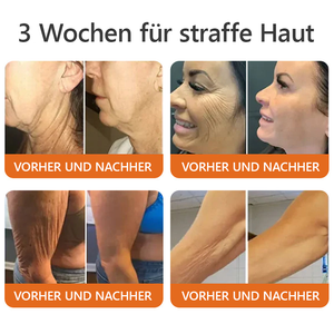 1+1 Gratis | Beuven™ - All-in-One-Reparaturcreme