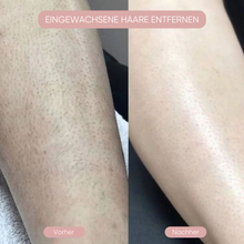 Lade das Bild in den Galerie-Viewer, Delvora Intimrasierer 2-in-1
