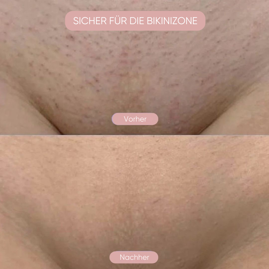 Delvora Intimrasierer 2-in-1
