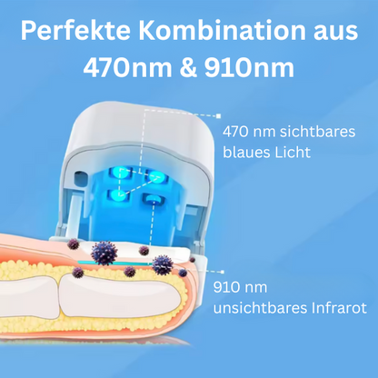 LLLT Nagelpilz - Revolutionäres hocheffizientes Lichttherapiegerät für Zehennagelkrankheiten