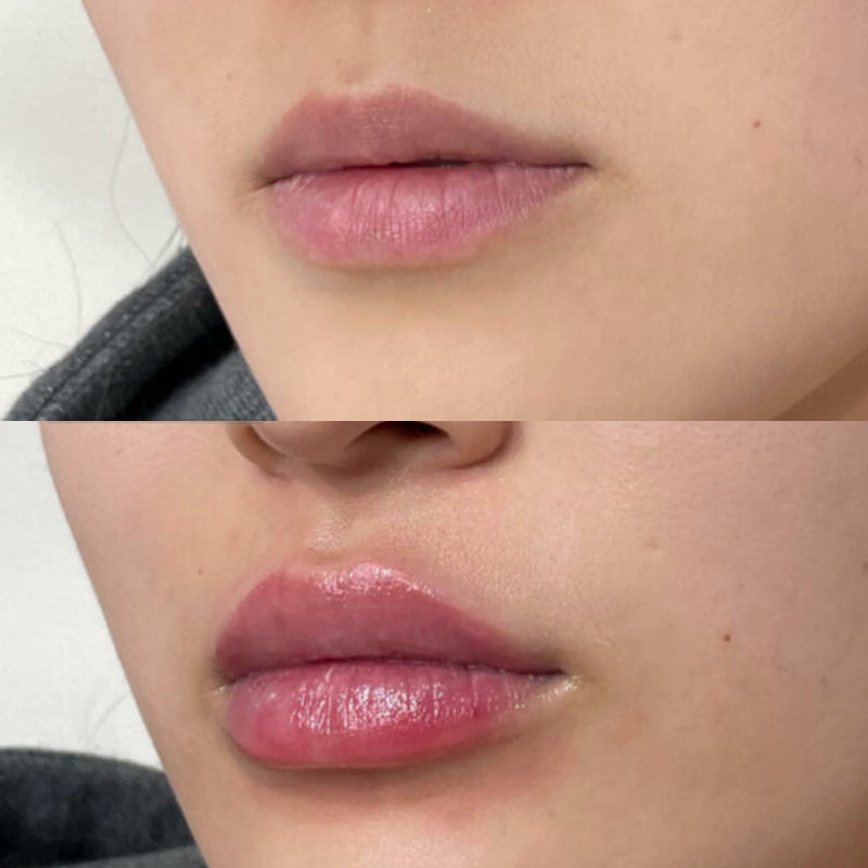 Lippenfüller mit Vitamin E - natürliches Serum - schnelle Wirkung & langanhaltend_4