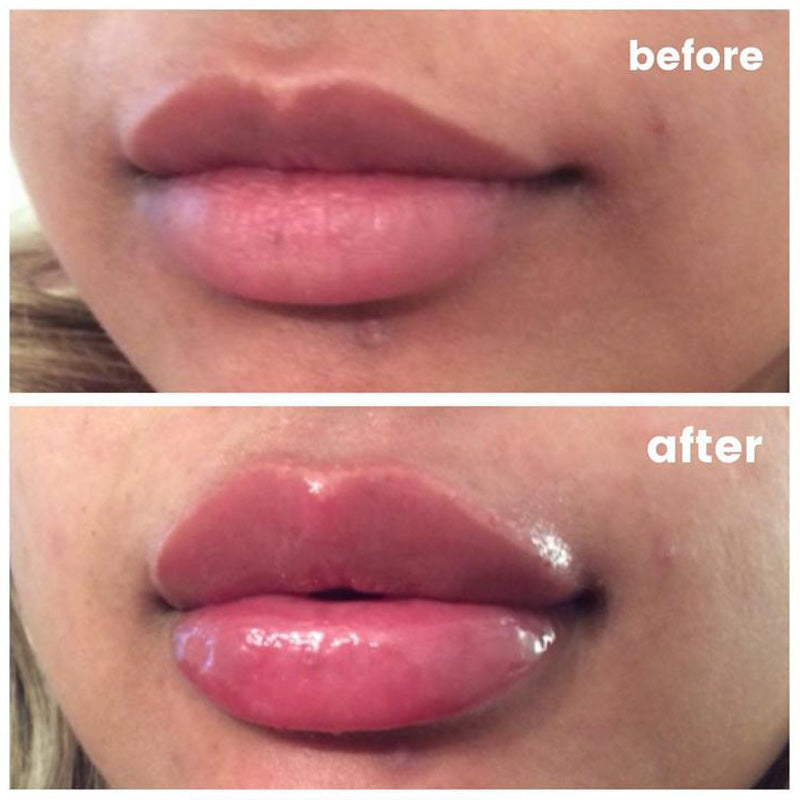 Lippenfüller mit Vitamin E - natürliches Serum - schnelle Wirkung & langanhaltend_8