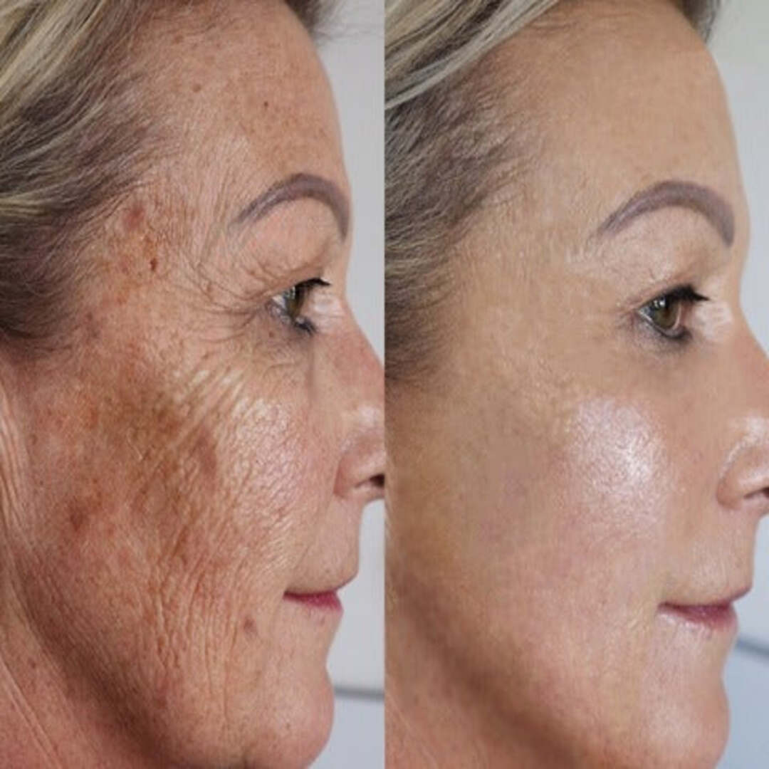 1+1 GRATIS | Exzellentes Anti-Falten Serum