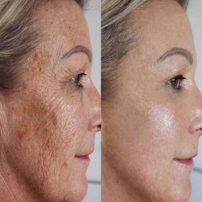 1+1 GRATIS | Exzellentes Anti-Falten Serum