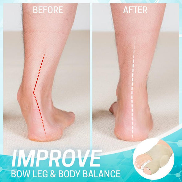 Ballenzeh-Korrekturhülse | 1+1 PAAR GRATIS