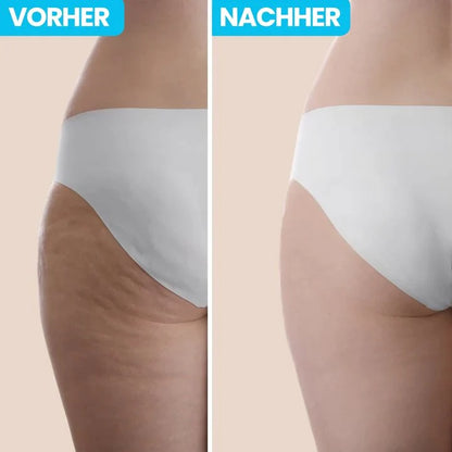 VibraSculp™ Anti-Cellulite Infrarot-Massagegerät