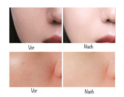 (1+1 GRATIS) Skin Care Gel -  Gesichtsgrundierung für unsichtbare Poren