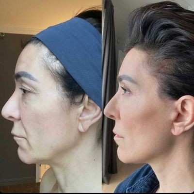 YoungMe - Kollagen Boost Anti-Aging Serum