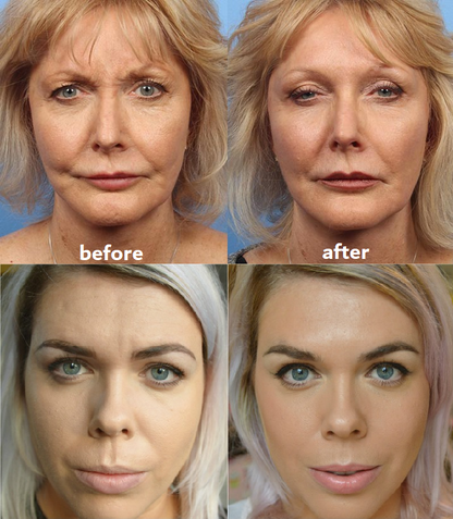 ANTI-FALTEN-PADS | 50% RABATT HEUTE