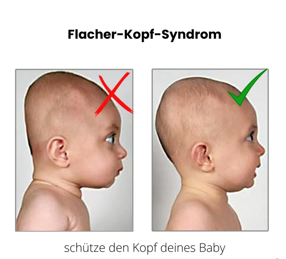 Verstellbares Babybett - gegen Plattkopf und Verdauungsprobleme  - arzt empfehlung