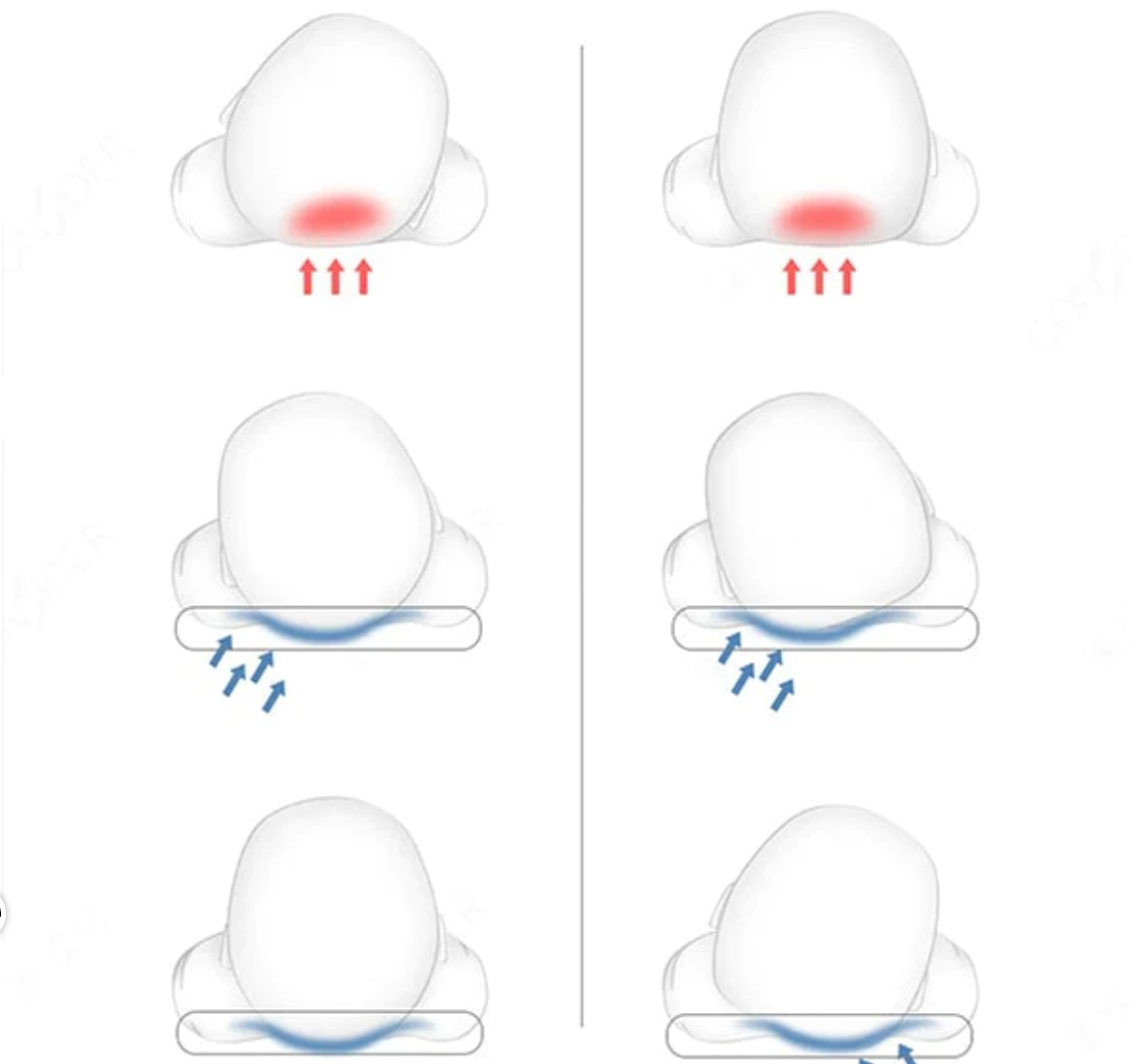 Verstellbares Babybett - gegen Plattkopf und Verdauungsprobleme  - arzt