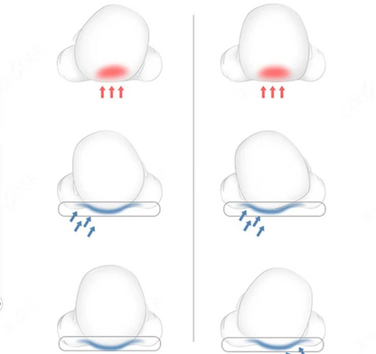 Verstellbares Babybett - gegen Plattkopf und Verdauungsprobleme  - arzt