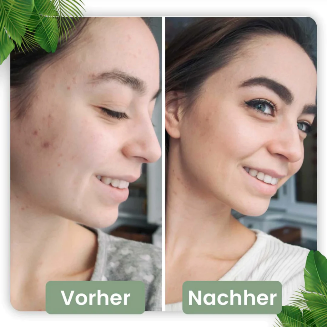 Poren Tiefenreinigungs-Maske Stick I Grüner Tee-Extrakt 1 7