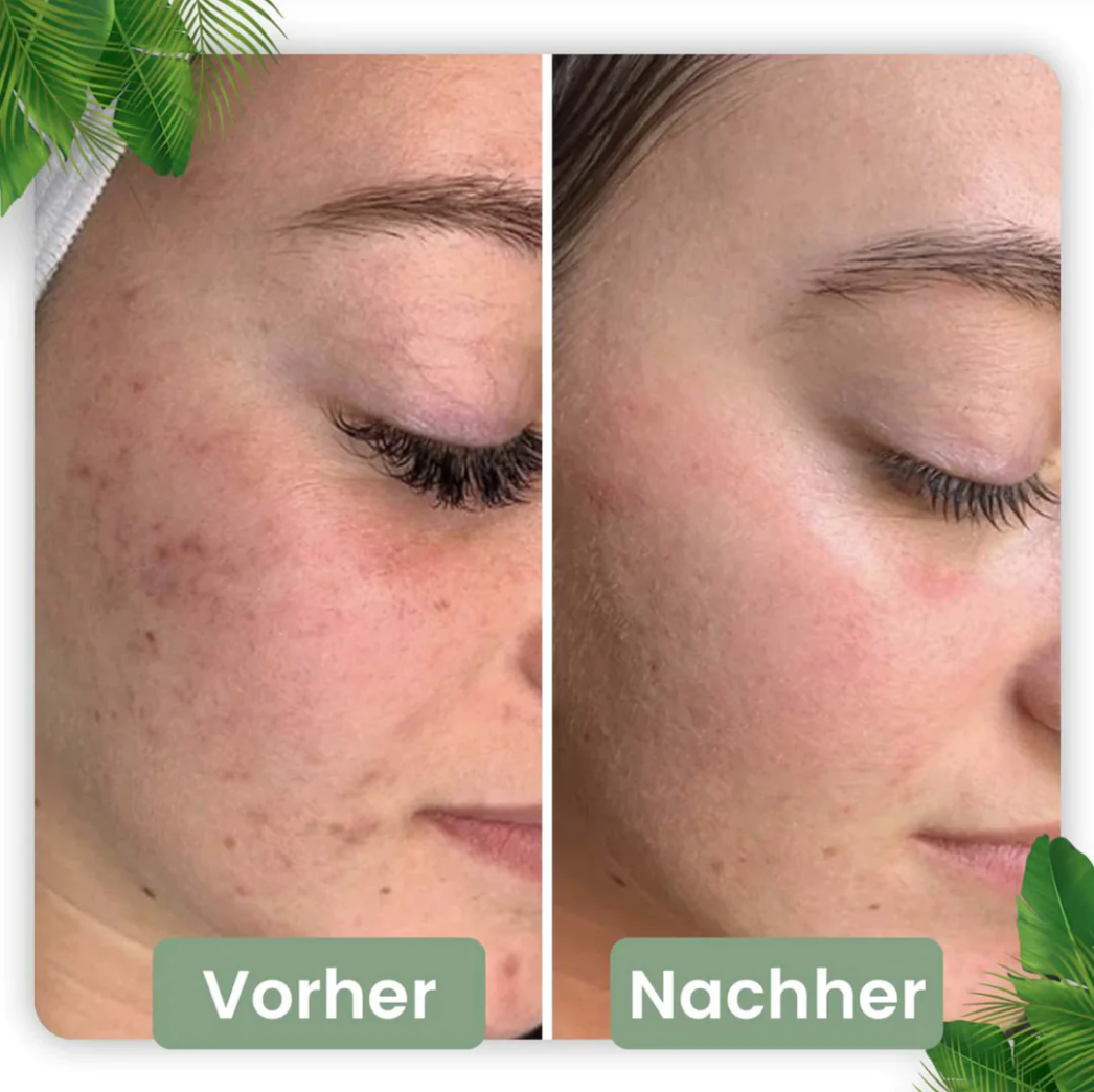 Poren Tiefenreinigungs-Maske Stick I Grüner Tee-Extrakt 144