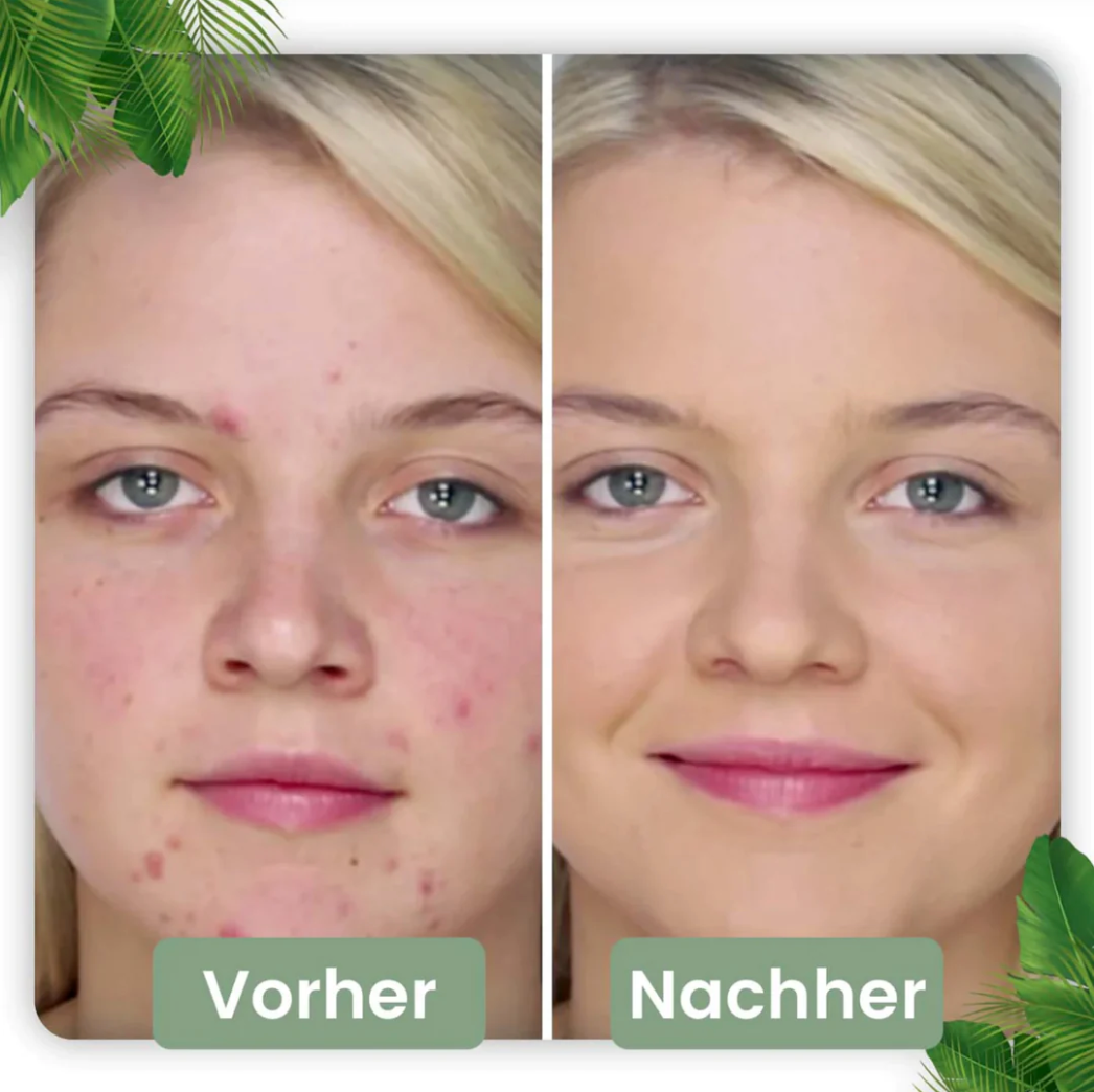 Poren Tiefenreinigungs-Maske Stick I Grüner Tee-Extrakt 1 5