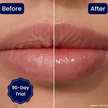 Lade das Bild in den Galerie-Viewer, Lippen Booster - Vitamin E Lippen auffüllendes Serum

