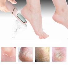 Lade das Bild in den Galerie-Viewer, Soft Feet™ | Nie wieder Schwielen an den Füßen!
