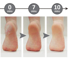 Lade das Bild in den Galerie-Viewer, Soft Feet™ | Nie wieder Schwielen an den Füßen!
