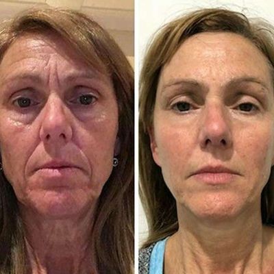 YoungMe - Kollagen Boost Anti-Aging Serum